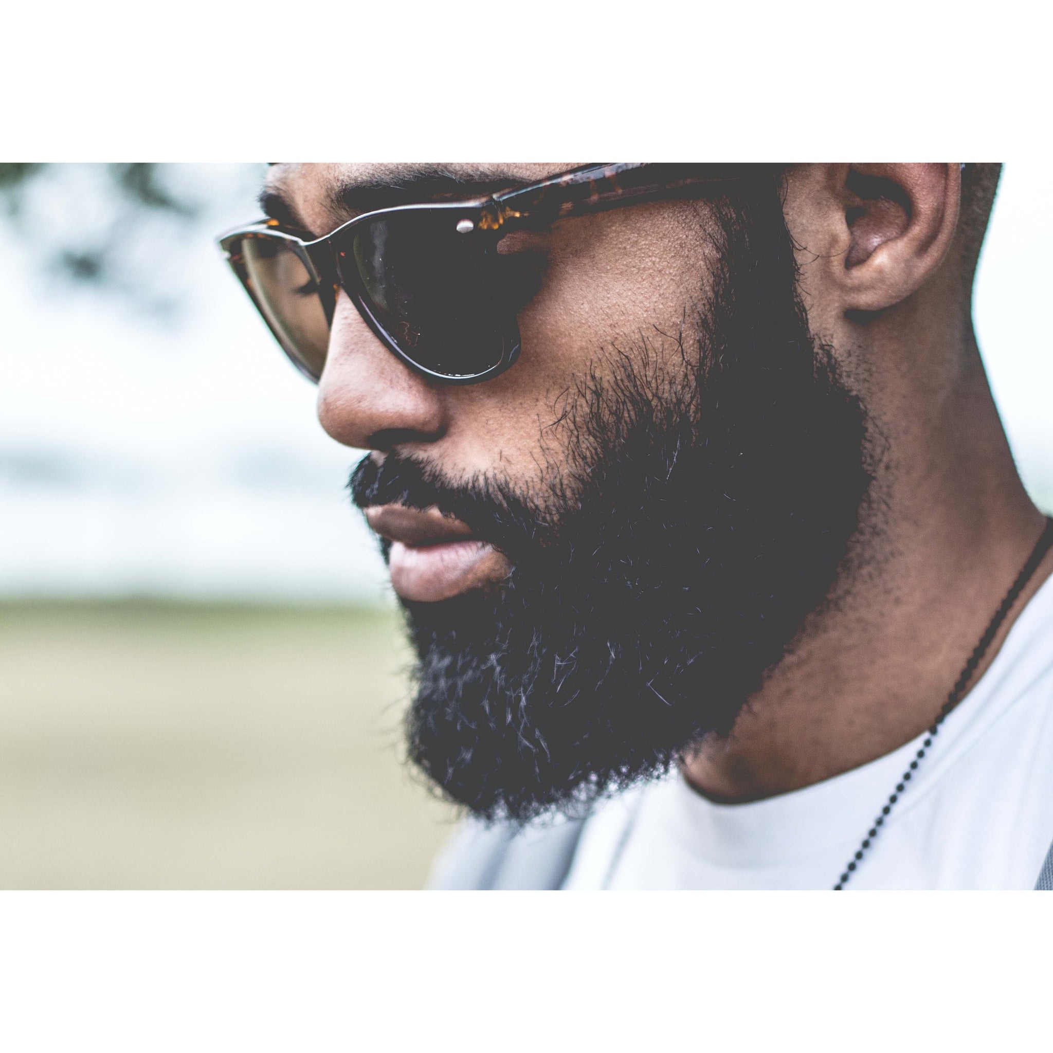 Zap It Oil (for Itchy Scalp, Acne, & Razor Bumps)